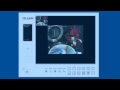 IP Phones video